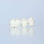 Everything You Need to Know About Porcelain Crowns_FI