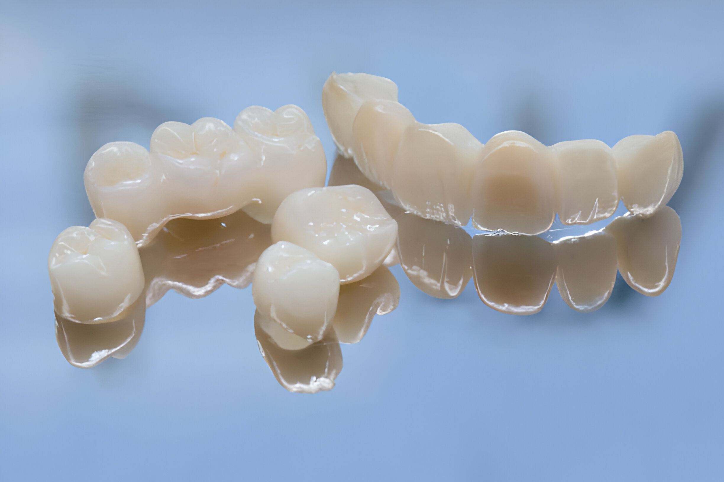Everything You Need to Know About Porcelain Crowns_1