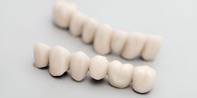 How Long Do Dental Crowns Last? Understanding Longevity and Care_FI